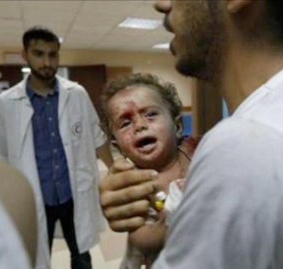 verletzte Kinder in Gaza