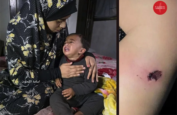 Kleinkind aus Gaza gefoltert