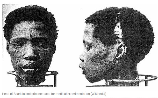 Köpfe von gefangenen Namaqua Menschen wurden nach Deutschland gebracht für weitere 'medizinische Forschung'