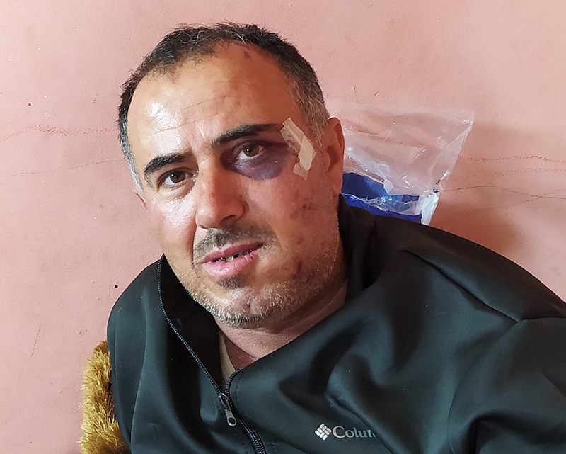 Said Abu Aliyan im Al-Ahli Hospital in Hebron, nach einer Attacke durch israelische Siedler am 13.03.21